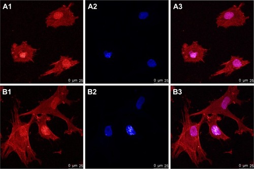 Figure 3 CLSM images of hPDLSCs adhesion on HA (A1–A3) and mnHA (B1–B3) at 6 hours after seeding.Notes: The actin filament was stained red by phalloidin (A1, B1) while the cell nuclei were stained blue by DAPI (A2, B2). (A3, B3) were the merge of (A1, A2) and (B1, B2) respectively. Scale bar =25 μm.Abbreviations: CLSM, confocal laser scanning microscope; hPDLSC, human periodontal ligament derived stem cell; HA, hydroxyapatite; mnHA, micro-nano-hybrid surface; DAPI, 4′,6-diamidino-2-phenylindole dihydrochloride.