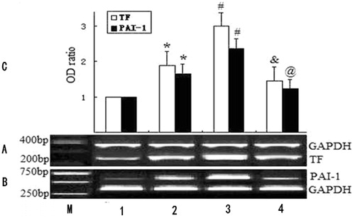 Figure 1. mRNA expression of TF and PAI-1 in PBMCs. Control indicates normal group; (A) RT-PCR analysis of TF mRNA expression (upper bands: GAPDH mRNA,346 bp; lower bands: TF mRNA, 254 bp); (B) RT-PCR analysis of PAI-1 mRNA expression (upper bands: PAI-1 mRNA, 596 bp; lower bands: GAPDH mRNA,346 bp); M: Marker; lane 1: normal group; lane 2: CAPD group; lane 3: LPS-treated group; lane 4: LPS and fasudil-treated group. (C) Determination of relative signal intensity of TF and PAI-1 expression. Bar graph represents quantification of TF/GAPDH or PAI-1/GAPDH mRNA signals of 3 reproductions of independent experiment. For each group, mean ± SD. *p < 0.05 health group vs. CAPD group. #p < 0.05 CAPD group vs. LPS-treated CAPD group. &p < 0.05 LPS-treated CAPD group vs. LPS and fasudil-treated CAPD group. @p < 0.01 LPS-treated CAPD group vs. LPS and fasudil-treated CAPD group.