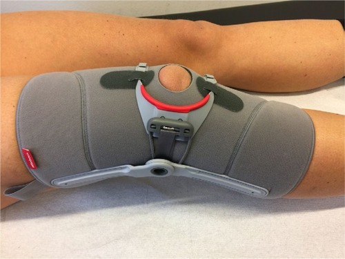 Figure 7 Example of a patella realignment brace (Agillium Patella pro; Otto Bock, Duderstdt, Germany).