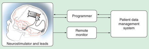 Figure 2. The RNS System. The implantable components of the RNS System include a neurostimulator and depth and cortical strip leads. The programmer is a laptop computer with proprietary software and custom telemetry components that the physician uses to communicate with the neurostimulator. The programmer can configure neurostimulator settings and retrieve data stored on the neurostimulator. The remote monitor is a home-use monitoring device used by the patient to retrieve data stored on the neurostimulator. The PDMS is a centralized database, which contains data uploaded from the programmer and remote monitor. Neurostimulator data and detection settings can also be transferred from PDMS to the programmer.