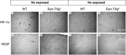 Figure 3 Cerebral angiogenesis in Epo-TAgh mice.