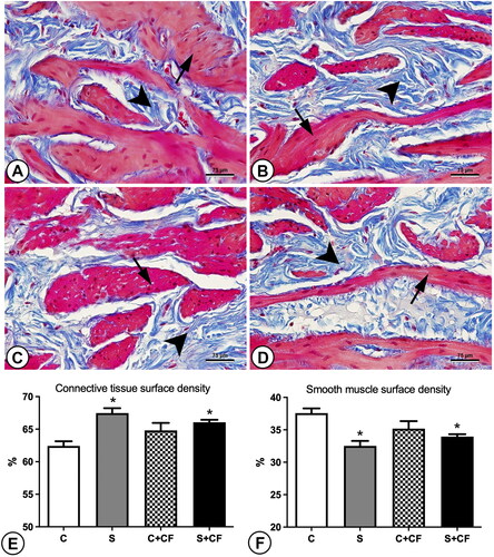 Figure 1. Photomicrographs and graphics representing the connective tissue (shown in blue and pointed by arrowheads) and smooth muscle contents (shown in Pink and pointed by arrows) in the bladder wall of different groups. (A) Control group (B) Stressed group (C) Control + comfort food group (D) Stressed + comfort food group. Sections were stained using Masson’s trichrome and captured under 600× magnification. The higher presence of connective tissue (blue stained areas) indicates tissue fibrosis. (E) Connective tissue surface density, (F) smooth muscle surface density. Asterisks represents statistical differences (p = 0.0005) between stressed and control animals. Scale bar represents 75 µm.