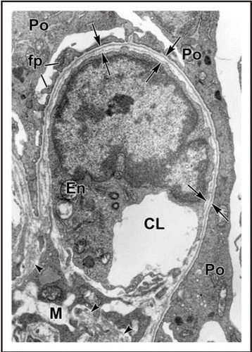 Figure 3 Electron micrograph of developing glomerular capillary loop. The endothelial cell (En) is large and contains only a few fenestrations at this stage. Only a few, relatively broad foot processes (fp) are present in the podocyte (Po) cell layer. A double basement membrane between the endothelium and podocytes can be seen clearly (arrows). Note the loose mesangial matrix (arrowheads) in the mesangium (M). Reproduced with permission (ref. Citation36).