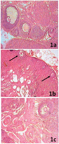 Figure 1. (a) Ovarian section of control rats showing follicles at different stages of maturation and recent ovulation is documented by few functional corpora lutea scattered throughout the periphery (100×). (b) Ovarian section of arsenic-treated rats exhibiting scarce number of follicles and atretic cells with arrested growth at preantral stage (arrow) and a significant part of the stroma is filled by fibrous connective tissue (100×). (c) In greater than 60% of the HPD-supplemented group ovaries, there is major restoration of follicular growth and maturation. Presence of few fully functional corpora lutea marks recent past ovulation (100×).