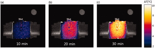 Figure 7. MRI temperature maps on the mid-plane of the phantom taken every 10 min during RF heating. RF heating was stopped during each 15-s round of MR thermometry.