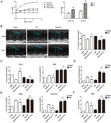 Figure 1 Impaired cardioprotective effects in response to GLP-1 in diabetic mice after myocardial IRI. (A) Elevated circulating GLP-1 level induced by myocardial IRI. *P<0.01 vs 0 hr+NDM+IRI group and 0 hr + DM + IRI group; #P<0.05 vs 0 hr + NDM + IRI group. (B) Representative echocardiography and LV fractional shortening change of each group. *P<0.05 vs NDM + IRI group. (C) QRT-PCR analysis of Bcl-2 and BAX. *P<0.05 vs NDM + IRI group. (D) Caspase-3 activity assay. *P<0.05 vs NDM + IRI group. (E) QRT-PCR analysis of NOX4 and p22-phox. *P<0.05 vs NDM + IRI group. (F) ROS measurement. *P<0.05 vs NDM + IRI group.