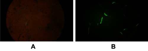 Figure 1 MSCs transduction with viral GFP. (A) Fluorescent and phase contrast images were merged. (B) Fluorescent image of the same frame. Low efficiency of transduction can be observed.Abbreviations: MSCs, mesenchymal stem cells; GFP, green fluorescent protein.