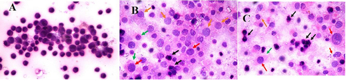 Figure 5 (A) Photomicrograph demonstrated regular cells with nuclear pleomorphism and hyperchromatic nuclei. (B) A photomicrograph showed necrotic cells with combined euchromatin and heterochromatin (red arrows), Intranuclear eosinophilic structures (orange arrows), Ruptured cell membranes (green arrows), Shrunken apoptotic cells with nuclear membranes and irregular cell (black arrows) and (C) A photomicrograph demonstrating necrotic cells with combined euchromatin and heterochromatin (red arrows), Intranuclear eosinophilic structures (orange arrows), Ruptured cell membranes (green arrows), Shrunken apoptotic cells with nuclear membranes and irregular cell (black arrows) (H and E, Original magnification 100×, Oil).
