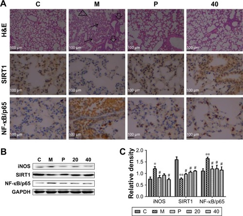 Figure 7 Effects of the nucleosides on lung histological changes measured by H&E staining and the associated protein expression by immunohistochemistry and Western blot analysis.