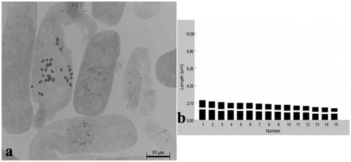 Figure 2. Klasea hakkiarica. (a) Metaphase chromosomes (scale bar 10 μm); (b) idiogram.