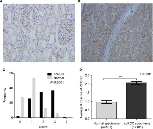 Figure 2 The protein expression of VEGFC in ccRCC.Notes: The protein expression level of VEGFC in ccRCC was measured using immunohistochemical staining. Representative adjacent normal renal tissues’ staining (A), ccRCC tissues’ staining (B), frequency distributions of protein expression across the cohort (C) and the average score of immunohistochemical staining (D) are shown. (A and B) Magnification ×100. ***P<0.001.Abbreviations: VEGFC, vascular endothelial growth factor C; ccRCC; clear cell renal carcinoma; IHC, immunohistochemistry.