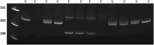 Figure 4.  X chromosome inactivation pattern of case I and case II. PCR products of undigested (U) and HpaII-digested (C) DNA from peripheral blood and testis (Case 1). XCI patterns of the cases. Line 1, marker (pUC mix 8), 331, 242 and 190 bp fragments are visible; line 2 and 3: male control; line 4 and 5, case I (PB); line 6 and 7, case I (T); 8 and 9 case II (PB); line 10 and 11, positive control. PB: Peripheral blood, T: Testis.