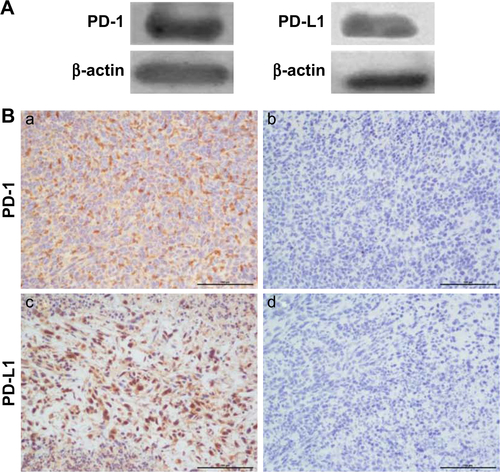 Figure S1 PD-1 and PD-L1 expression analysis in 4T1 mammary tumor tissues. (A) PD-1 and PD-L1 protein expressions were assessed in 4T1 mammary tumor homogenates. (B) Immunohistochemical analysis of PD-1 (a) and PD-L1 expression (c) in 4T1 mammary tumors. (b and d) IgG isotype staining served as a negative control for PD-1 and PD-L1. Scale bar =100 µm. (C) PD-1+ and PD-L1+ cell populations in TILs as determined by FACS (n=3).Abbreviations: FACS, fluorescence-activated cell sorting; TILs, tumor-infiltrated lymphocytes.