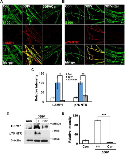 Figure 1. Inhibition of TRPM7 prevents trans-dedifferentiation of Schwann cells in ex vivo sciatic nerves. (A,B) Sciatic nerve fibers were immunostained with anti-S100 (green), anti-lysosomal-associated membrane protein (LAMP)-1 and anti-p75 neurotrophin receptor (p75NTR). Scale bar = 50 μm. (C) Relative intensities quantified the increase of LAMP1 and p75NTR expression in ex vivo trans-dedifferentiated Schwann cell (n = 3). (D) Western blot analysis showed protein expression of TRPM7 and p75NTR in ex vivo sciatic nerves. (E) Relative intensities indicated the effects of TRPM7 inhibition on trans-dedifferentiation (n = 9).
