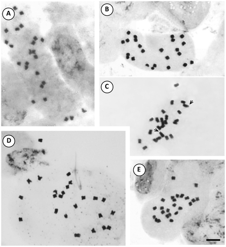 Figure 7. Photomicrographs of mitotic metaphases in Solanum species of Dulcamaroid clade with 2n = 24. (A) S. endoadenium; (B) S. salicifolium 3488; (C) S. salicifolium 818; (D) S. salicifolium 3158; (E) S. salicifolium 794. Scale bar = 6 μm, all photomicrographs at the same scale. Arrows indicate satellites.
