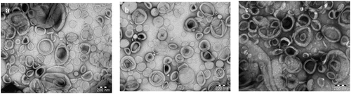 Figure 1. TEM images of plain liposomes (a), 5-FU loaded liposomes (b) 5-FUC loaded liposomes (c). (Bar = 200 nm)