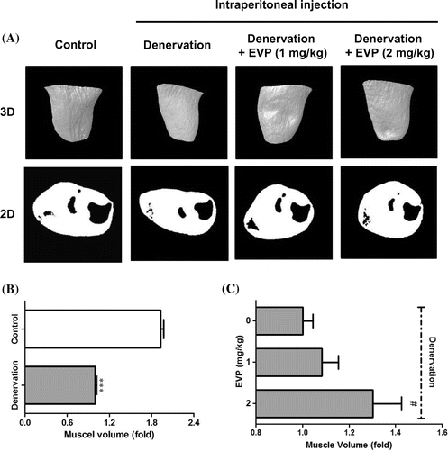 Fig. 1. Effects of intraperitoneal injection of EVP on disuse muscle atrophy by sciatic denervation in mice.