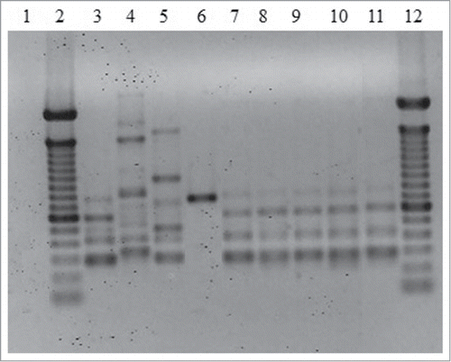 Figure 2. Representative T3B PCR fingerprinting profiles of the 5 Sporothrix isolates. (1) Negative control. (2 and 12) Molecular marker DNA ladder, 100 bp (Invitrogen). (3) S. brasiliensis (CBS120339). (4) S. mexicana (MUM11.02). (5) S. schenckii (ATCC32286). (6) S. globosa (IPEC27135). (7) IPEC32742. (8) IPEC33070. (9) IPEC33718. (10) IPEC33946. (11) IPEC43174.