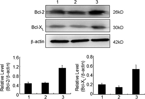 Figure 11. Expression levels of Bcl-2 and Bcl-XL in KM3 cells under various culture conditions as assessed by western blot. (1) The KM3 group, (2) The KM3/hUCBDSC co-culture group, (3) The KM3/MM-BMSC co-culture group. After sub-culture for 4 days, KM3 cells from each of the three groups were collected, and the expression levels of Bcl-2 and Bcl-XL were then examined by western blot. The expression levels of Bcl-2 and Bcl-XL in KM3 cells from the KM3/hUCBDSC group were lower than that observed in the KM3/MM-BMSC group. Each experiment was performed three times. hUCBDSCs, human umbilical cord blood-derived stromal cells; MM-BMSCs, multiple myeloma bone marrow stromal cells.