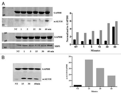 Figure 4. acALY18 forms a disulfide bond with its putative protein target XPB1. (A) Western analysis of human fibroblasts treated with 25 nM thapsigargin and probed for acALY18 (left) or XBP1 (right) at various time points post-treatment. The bar graph of the densitometry measurement shows increased XBP1 (■) expression preceding acALY18 (■) expression. (B) Normal human fibroblasts were treated for 30 min with 25 nM thapsigargin (Tg) and the whole cell lysates were reduced with DTT/BME for 15, 30, or 60 min and analyzed by western. Densitometry measurement of acALY18 levels were normalized to GAPDH (bar graph). NT, no treatment.