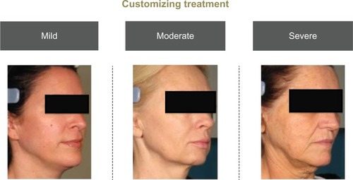 Figure 2 Customizing treatment depending on laxity severity.