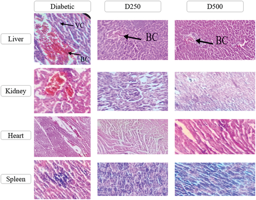 Figure 11. Histological section of the different organs of treated and untreated individuals (G: 40x10) (BC: Blood congestion; VC: Vacuolization of the cytoplasm).