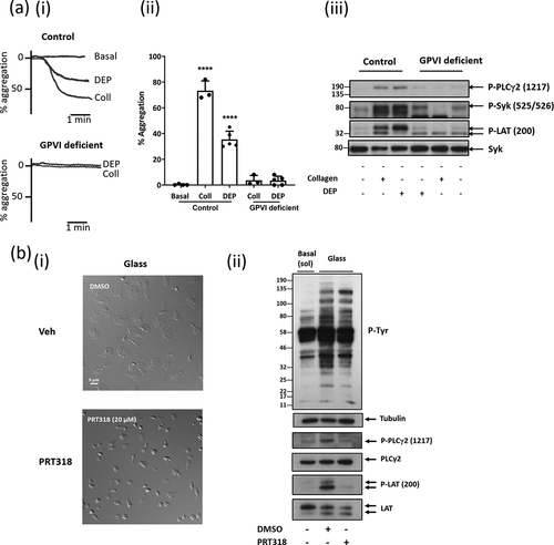 Figure 3. Charged DEPs and negative charged surfaces activate human platelets through a GPVI and Syk dependent manner. a) Commercially bought DEP (50 µg/mL; see Supplementary Materials for details) induced platelet aggregation is abolished in GPVI-deficient patients. (i) Representative aggregation trace of DEP and collagen (Coll; 30 µg/mL) induced aggregation in washed platelets (4x108/mL) from controls (+/+) and GPVI deficient patients (individuals homozygous (−/−) for a mutation in GP6 resulting in truncated GPVI). For more details see Supplementary Materials. (ii) Significant reduction in DEP-aggregation and collagen-induced platelet aggregation in GPVI deficient individuals. One-way ANOVA with Tukey’s multiple comparisons test, n = 3–5, ****p < .0001 to basal. (iii) Representative western blot for tyrosine phosphorylation of PLCγ2, Syk and LAT following collagen and DEP stimulated washed platelets from GPVI-deficient individuals and control individuals. b) Platelet spreading on glass (charged surface) is abolished with Syk inhibition. (i) Washed platelets (2x107/mL) spread on glass (negatively charged surface) for 30 min. Platelets were pre-incubated with 20 μM PRT-060318 (Syk inhibitor) or DMSO (vehicle) 5 min before spreading. Scale bar = 5 μm. (ii) Western blot for tyrosine phosphorylation of signaling proteins after platelets were spread on glass. Representative of 3 experiments