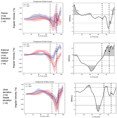 Figure 4. Tri-planar IMU kinematic data for the 7-iron with corresponding statistical parametric analysis “Swing Onset” occurs at 0, the first vertical dotted line indicates the “Top of Swing” event, the second vertical dotted line indicates the “Impact” event and “Swing End” occurs at 100.