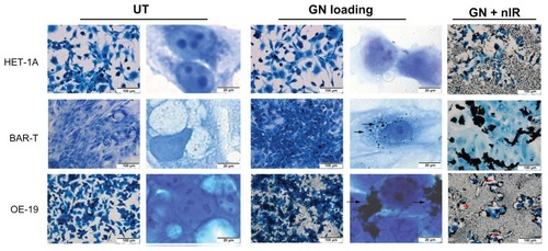 Figure 3 Cytotoxic effect of loading with gold nanoparticles in three esophageal cell lines (first column is lower magnification and second column is higher magnification).Notes: Arrow: gold nanoparticle loading in cells. Red arrow head: cells were removed after near infrared light exposure.Abbreviations: UT, untreated; GN, gold nanoparticles; GN + nIR, gold nanoparticles treated with infrared light.