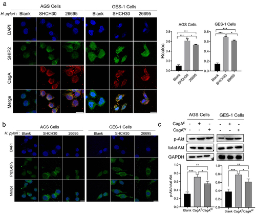 Figure 2. The effect of H. pylori infection on the sub-localization of SHIP2, production of PI(3,4)P2 and activation of Akt signaling.