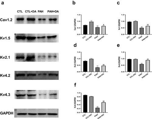 Figure 5. Effects of Dapagliflozin administration on Ion channel proteins in PAH’s rats. Representative Western blots (a). Quantitative results of the Cav1.2 (b), Kv1.5 (c), Kv2.1 (d), Kv4.2 (e), Kv4.3 (f) (n = 3 per group). Data are presented as mean as ±SEM. *P < 0.05 vs. CTL group, #P < 0.05 vs. PAH group. **P < 0.01 vs. CTL group, ##P < 0.01 vs. PAH group.