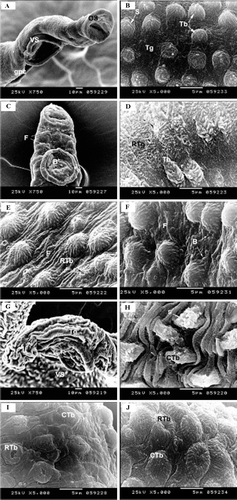Figure 9.  Photomicrographs of control and treatedSchistosomamansoni tegument. A, Control male worm showing os, vs and gpc. B, The tegument of the middle part of the control worm covered with Tb armed with s and sponge like Tg. C,In vivo treated worms with HPE showing a few blebs (B) and transverse folds (F). D,In vivo treated worm with HPE showing the RTg and deformed Tb. E,In vivo treated male worms with AME showing transverse folds (F) and (RTb). F,Invivo treated worms with CGE showing the tegument with numerous blebs (B) and rough tegument with transverse folds (F). G,In vitro treated worm with AME showing severe shrinkage of both Tg and vs. H,In vitro treated worm with AME showing CTb with deformed s. I,In vitro treated worm with CGE showing CTb and RTb. J,In vitro treated worm with HPE showing RTb and CTb. os, oral sucker; vs, ventral sucker; gpc, gynechophoric canal; Tb, tubercles; s, spines; Tg, tegument; HPE,Holothuriapolii extract; RTg, rough tegument; AME,Actinopygamauritiana extract; RTb, ruptured tubercles; CGE, cuvierian gland extract; CTb, collapsed tubercles.