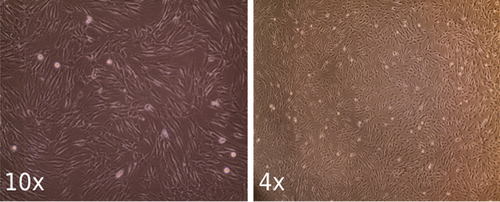 Figure 2. Sample fibroblast cells images from the dataset with 10x and 4x magnifications.