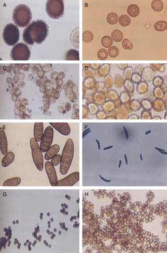 Figure 1.  Morphological examination of different spores/teliospores of wheat fungal pathogens at 40× magnification. (A) Tilletia indica; (B) Tilletia foetida; (C) Puccinia recondita; (D) Puccinia striiformis; (E) H. sativum; (F) Fusarium spp.; (G) Aspergillus niger; (H) Ustilago nudo tritici.