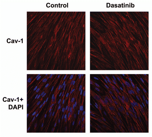 Figure 4 Dasatinib has no effect on Cav-1 levels in stromal fibroblasts cultured alone. As in Figure 3, except that fibroblasts were cultured alone, in the absence of MCF7 cancer cells. Note that Dasatinib treatment does not affect expression of Cav-1. Control represents fibroblasts alone treated with vehicle alone.