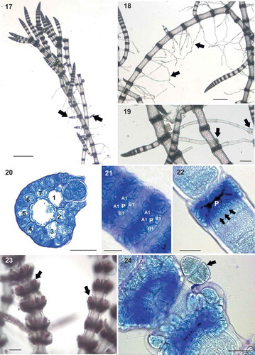 Figs 17–24. Ceramium sp.#4 (identified here as Ceramium incospicuum). Fig. 17. Prostrate axes giving rise to erect axes (arrows). Fig. 18. Main axes with abundant multicellular rhizoids (arrows). Fig. 19. Detail of rhizoids showing multicellular pads (arrows). Fig. 20. Section of a node with 7 rounded-quadrangular periaxial cells. Fig. 21. Nodal cortication of young axes showing periaxial cells (P), two acropetal cortical initials (A1) and two basipetal cortical initials (B1). Fig. 22. Nodal cortication of mature axes showing periaxial cell (P) and 2-celled basipetal cortical filaments (arrows). Fig. 23. Exserted tetrasporangia (arrows) protruding from the cortication and covered by a hyaline membrane. Fig. 24. Detail of tetrasporangium contents (arrow) detached from node. Scale bars: Fig. 17, 500 µm; Fig. 18, 250 µm; Fig. 23 and 19, 100 µm; Figs 20, 22 and 24, 50 µm; Fig. 21, 25 µm.