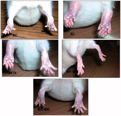Figure 1. Hind paws and ankle joint of representative rat groups at the 45th day. NC: normal control rat, AC: arthritic control rat showing redness, swelling, deformity and ankylosis with severe arthritis (symptoms maximum in the group), MTX: methotrexate treated rat with moderate arthritic symptoms, swelling only with moderate arthritis (symptoms maximum in the group), (WS 600) W. somnifera treated (600 mg kg−1) rat showing almost no sign of arthritis and appeared essentially normal (symptoms minimum in the group) and (WS 800) W. somnifera treated (800 mg kg−1) rat showing redness. Pictures are representative of six distinct rats per group.