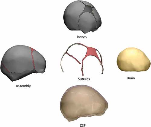 Figure 2. Surface meshes of the neonatal skull model in 3-matic software