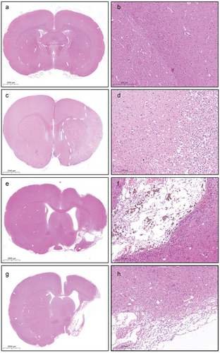 Figure 4. Pathological changes in rat brains at different time points. (a) Pathological examination of the brain in normal rats (hematoxylin and eosin [HE] staining, ×1.3). (b) Pathological examination of the hippocampus and cortex in normal rats (HE, ×20). (c) Brain pathology of rats seven days after pMCAO (HE, ×1.3). (d) Area of the injured brain in 7 days after pMCAO (HE, ×20). (e) Brain pathology of rats 28 days after pMCAO (HE, ×1.3). (f) Area of the injured brain 28 days after pMCAO (HE, ×20). (g) Brain pathology of rats 16 weeks after pMCAO (HE, ×1.3). (h) Area of the injured brain 16 weeks after pMCAO (HE, ×20).