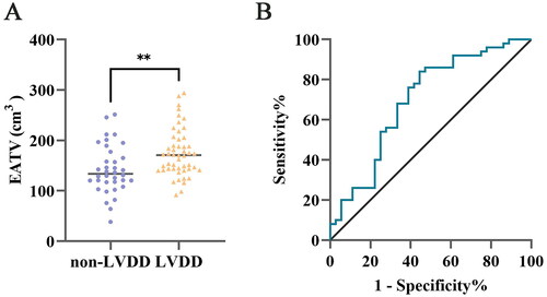 Figure 3. Comparative analysis of epicardial adipose tissue volume in Cushing’s syndrome subjects with and without left ventricular diastolic dysfunction and ROC curve analysis. A. Significantly increased EATV in CS patients with LVDD. B. ROC analysis revealed a significant correlation between EATV and LVDD (AUC 0.698, 95%CI 0.581–0.814, p = 0.002). CS Cushing’s syndrome, EATV epicardial adipose tissue volume, LVDD left ventricular diastolic dysfunction, ROC receiver operating characteristic. **P less than 0.01.