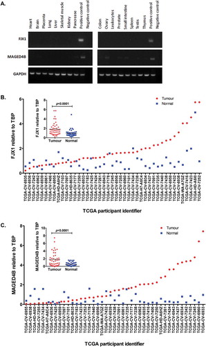 Figure 1. Levels of MAGED4B and FJX1 in normal human organs and HNSCC.(A) Semi quantitative PCR using commercially available normal human cDNA template (Human MTCTM Panel I and II) showed that both MAGED4B and FJX1 were expressed at low/negligible level in various human organs. cDNA from HeLa/T expressing FJX1 was used as positive control for FJX1 and cDNA from ORL-195 expressing MAGED4B was used as positive control for MAGED4B. (B) FJX1 expressions are elevated at transcriptomic levels in more than 60% of HNSCC cancer samples (n = 43), while C, MAGED4B expressions are elevated in about 40% in the HNSCC samples when compared to the matched normals. The relative expression of MAGED4B and FJX1 in all 43 HNSCC samples were normalised against TBP (TATA-Box Binding Protein).