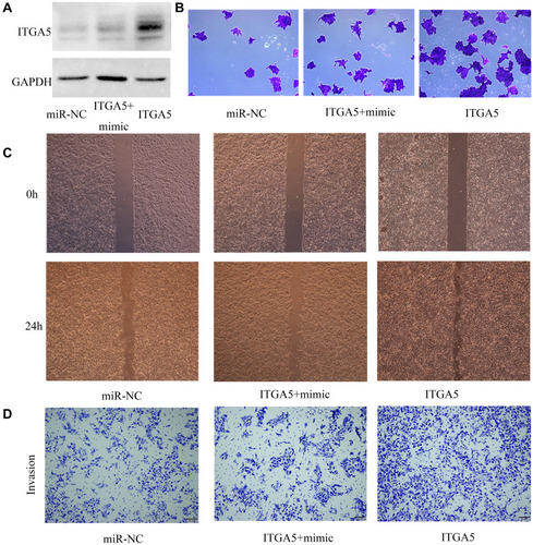 Figure 6 Restoration of ITGA5 reversed the inhibitory effects of miR- 27b on TSCC cells. (A) ITGA5 protein expression in the Cal 27 cell line was detected by Western blotting after 48 h culture in different groups (NC, ITGA5+miR-27b mimic, ITGA5). Colony formation (B), wound healing (C), and transwell (D) assays were performed in Cal 27 cells after transfection with NC, ITGA5+ miR-27b mimic, and ITGA5.