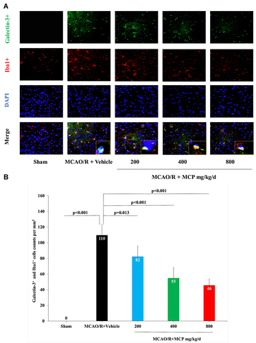 Figure 9 MCP treatment reduced the co-expression of galectin-3 and microglia, and TLR4, NF-κBp65 in C57BL/6J mice at 1 day after MCAO/R operation. (A) Representative double immunofluorescence staining images of cerebral cortex with galectin-3 (green) and Iba1 (microglia, red), counterstained with DAPI, n=3 per group, scale bar: 50μm. (B) Quantification of merged cells in the ischemic penumbra. Data are mean ± standard deviation.