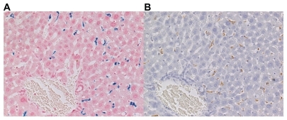 Figure 3 Histological study of the liver of mice sacrificed 48 hours after the intraperitoneal administration of ultrasmall superparamagnetic iron oxide. (A) Prussian-blue and (B) F4/80 stain (magnification ×200). Iron-positive areas were located at the hepatic sinusoid corresponding to the area harboring Kupffer cells and were consistent with areas positive for immunohistochemical staining.