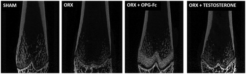 Figure 8. Coronal planes of femur performed by X-ray. Three-month-old male Wistar rats: sham-operated rats (SHAM) and orchidectomized rats (ORX) as baseline and castrated rats treated with 10 mg/kg/twice a week of OPG–Fc (ORX + OPG–Fc) or testosterone cypionate (1.7 mg/kg/once a week) (ORX + testosterone).