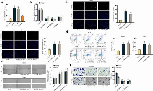 Figure 1. LINC00173 inhibits apoptosis of WT cells and promotes cell migration.(a) RT-qPCR was performed to quantify LINC00173 expression in HEK-293A cells and three WT cell lines, namely HFWT, G-401 and SK-NEP-1. (b) The knockdown efficiency of sh-LINC00173-1/2/3 was tested in HFWT and G-401 cells through RT-qPCR. (c-d) Apoptosis of HFWT and G-401 cells were evaluated by TUNEL assay and flow cytometry analysis. (e-f) Migration capabilities of WT cells were assessed through wound healing assay and transwell assay under LINC00173 knockdown. *P<0.05, **P<0.01.