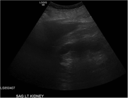 Figure 2. Left renal US shows no hydronephrosis, overall unremarkable