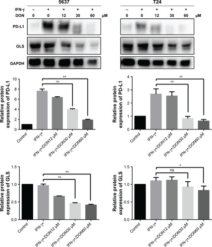 Figure 8 Protein levels of GLS and PD-L1 in 5637 and T24 stimulated by IFN-γ was determined after DON treatment at the concentrations indicated for 48 hours.