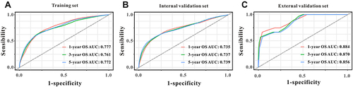 Figure 3 The predictive performances of the survival nomogram for predicting 1-year, 3-year and 5-year OS in PsI-DLBCL. ROC curves displayed that this survival nomogram discriminated well in training set (A), internal validation set (B) and external validation set (C).