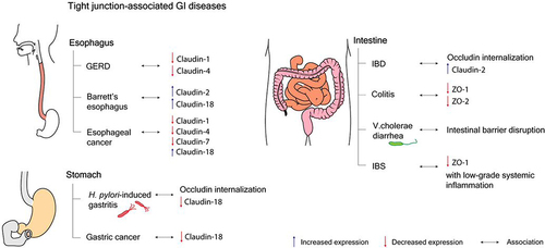 Figure 5. The relationship between increased tight junction-dependent paracellular permeability and the pathogenesis and progression of gastrointestinal diseases.